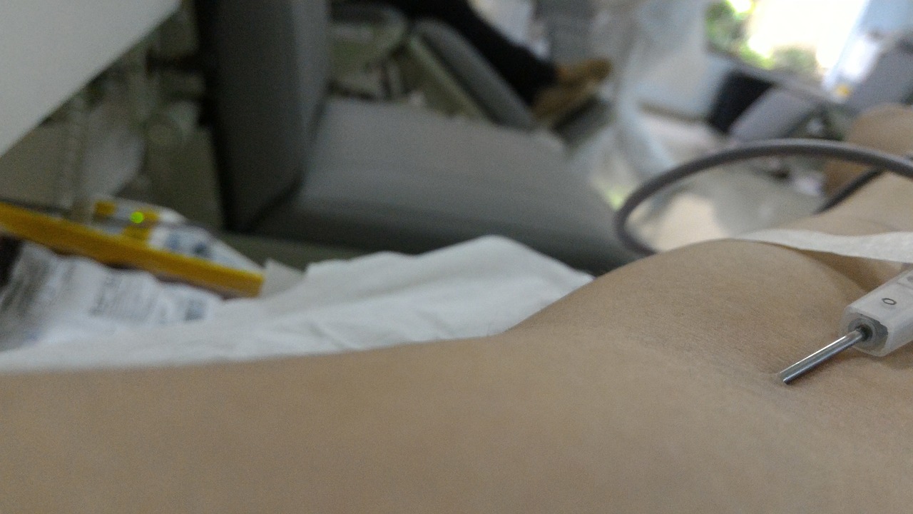 关于男子献血8次不能优先用血官方通报